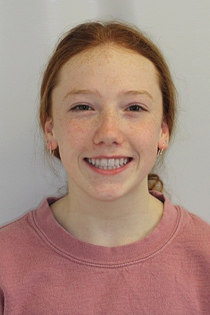 Young girl with beautiful smile after braces