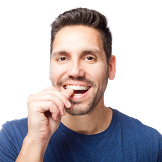 Man placing Invisalign clear aligner