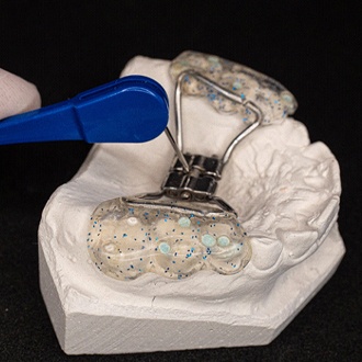 Dentist pointing to a palatal expander in Rutland