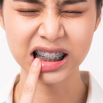a patient with braces suffering from mouth pain