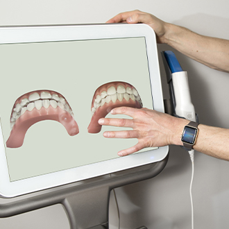 Digital dental impressions on chairside computer screen