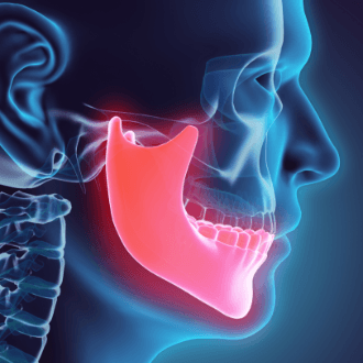 3 d animation of jaw and skull bone alignment